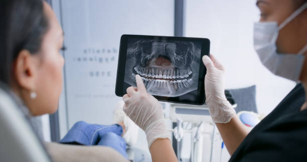 Licensed Tooth Extraction service in Rapid City, SD - Smile Center Dentistry